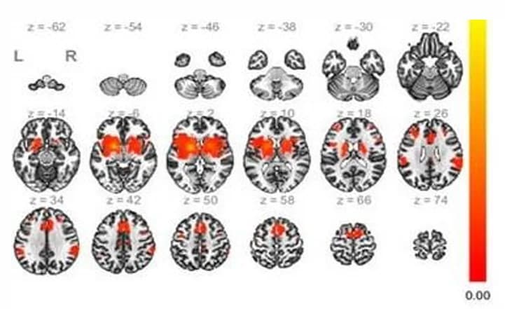 fMRI — 뇌 활성화 및 연결성 분석. 곧 공개됩니다.