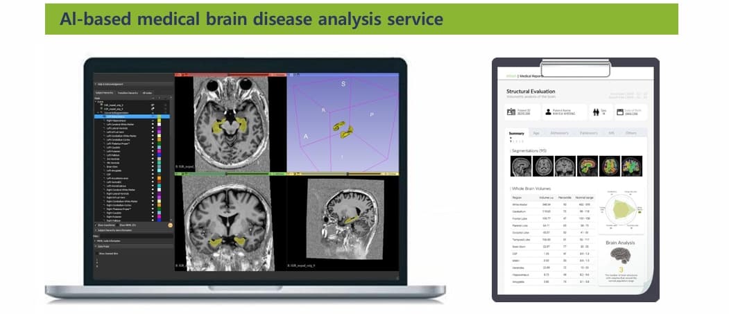 MTechLab AI MRI analysis processing pipeline: data ingestion, AI model inference, and structured report output