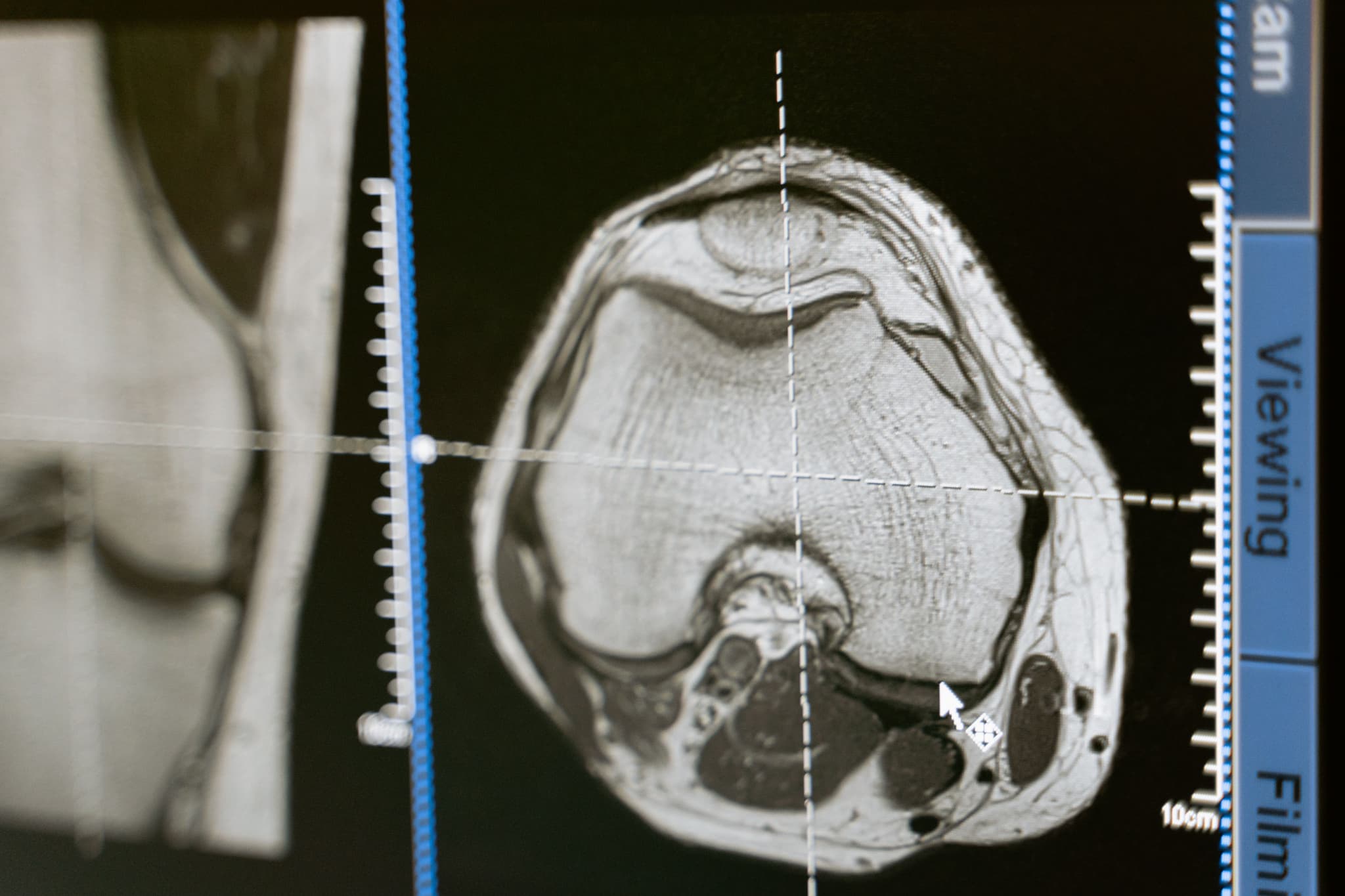 PACS/DICOM MRI image import interface