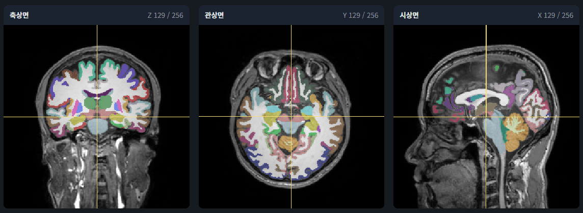 Supported MRI scan types: T1, T2, FLAIR, DWI, fMRI