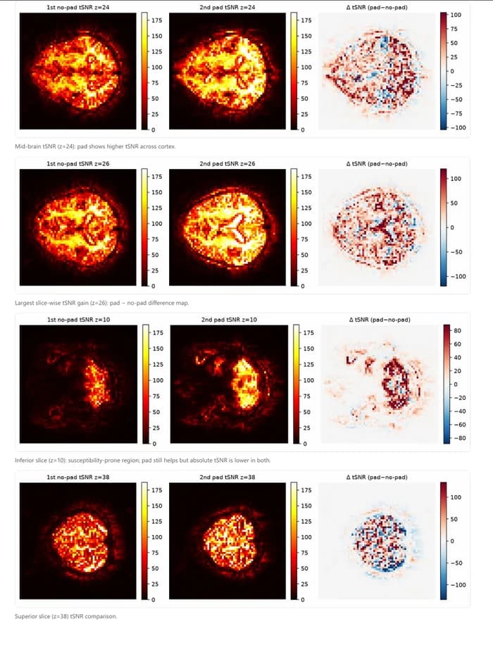 Page from an internal resting-state fMRI signal-quality report comparing temporal SNR maps without and with the dielectric pad