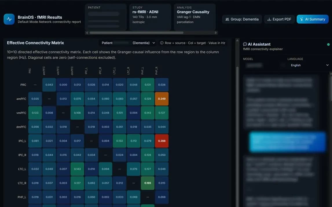 BrainDS + fMRI research prototype with a ten-by-ten region connectivity matrix, with subject details masked