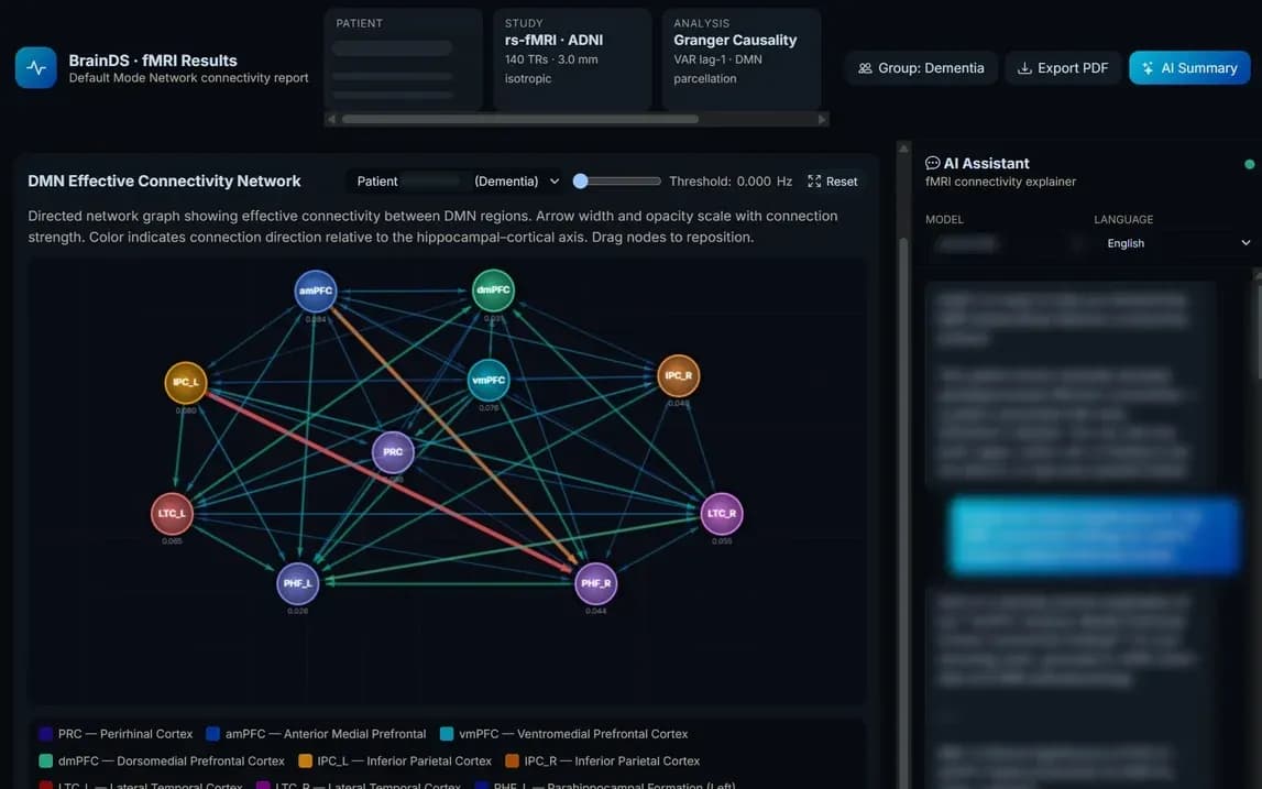BrainDS + fMRI research prototype with a directed connectivity graph between ten default-mode-network regions, with subject details masked