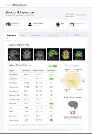 BrainDS structural report summary page with segmentation thumbnails, whole-brain volumes and a percentile radar, with patient details masked