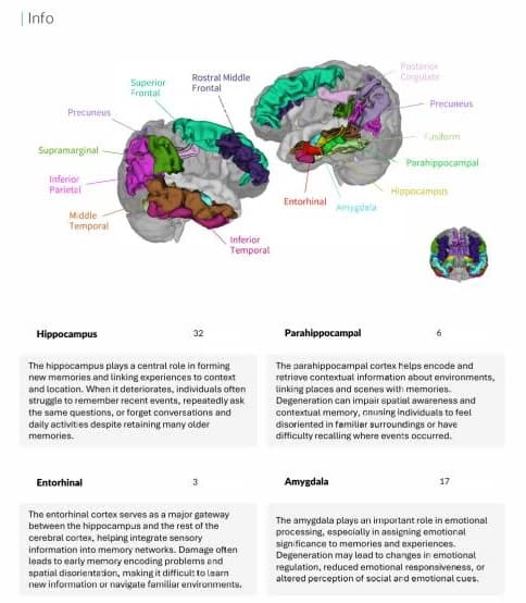 BrainDS + PET report page with a labelled 3D cortical region map and plain-language region cards