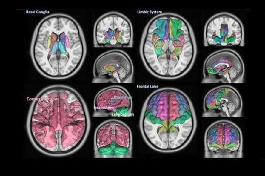 Brain Segmentation — Automated mapping of brain structures. Coming soon.