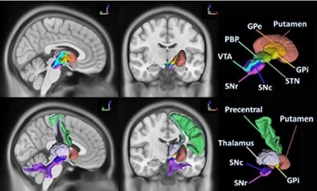 Diffusion MRI — White-matter pathway analysis. Coming soon.