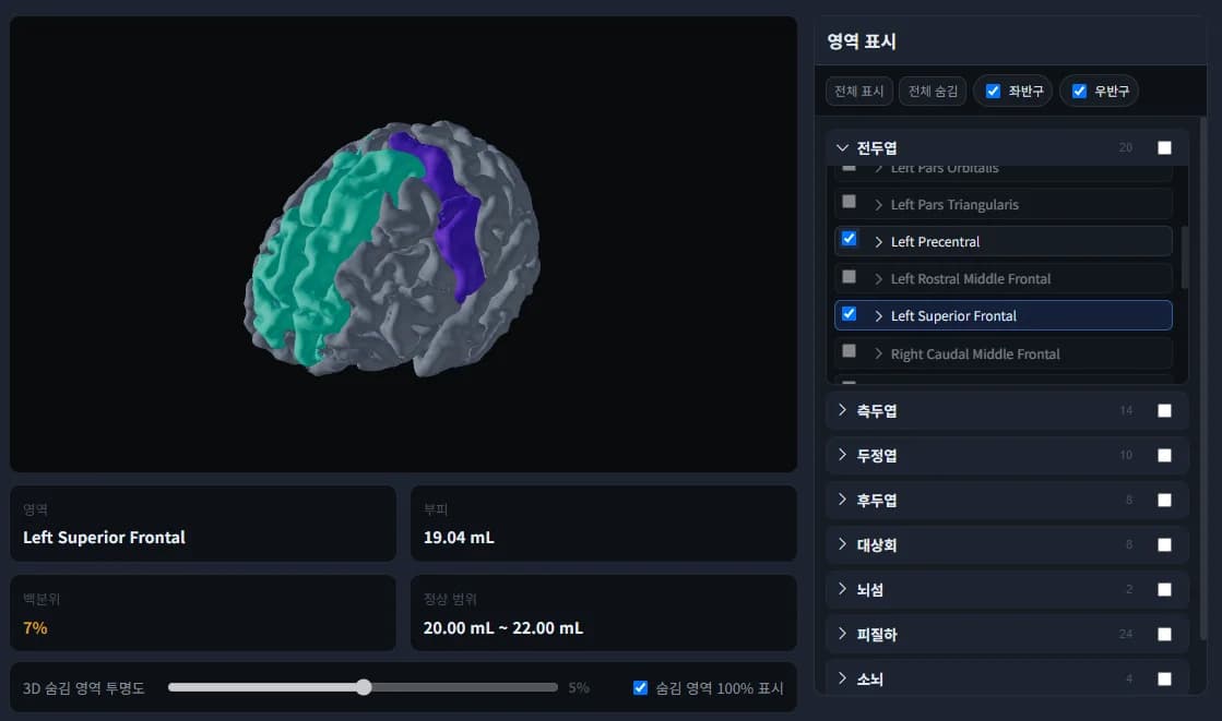 MTechLab AI analysis console showing an MRI image-processing workflow