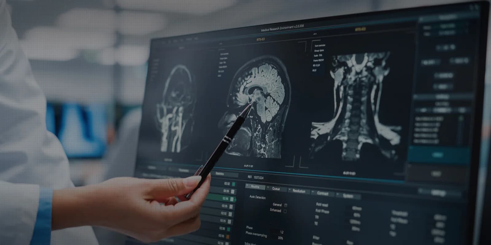 의료 영상 분석 워크스테이션에서 뇌·경추 MRI 영상을 검토하는 영상의학 전문의