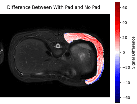 Abdominal signal difference map
