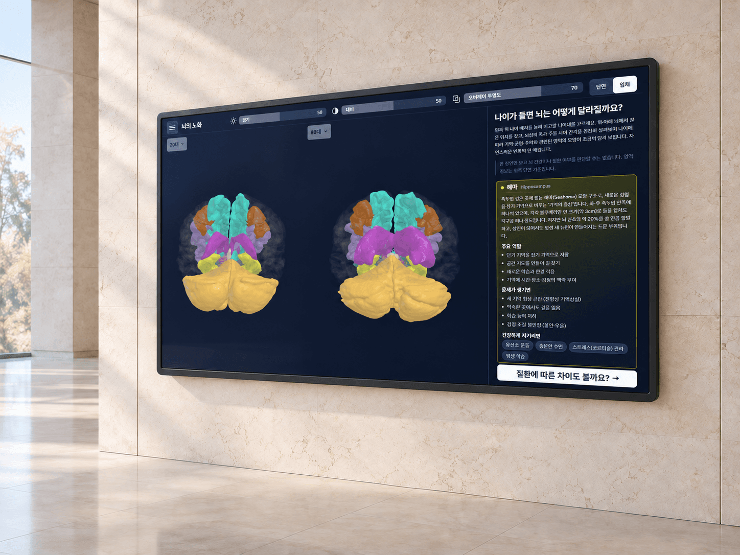Illustrative exhibit display showing an original MR.Brain-Edu brain-ageing comparison screen