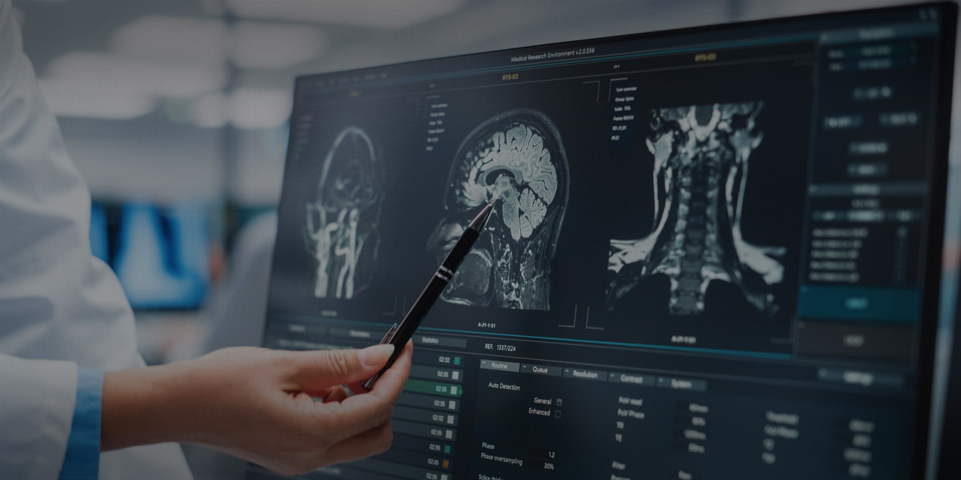 의료 영상 분석 워크스테이션에서 뇌·경추 MRI 영상을 검토하는 영상의학 전문의