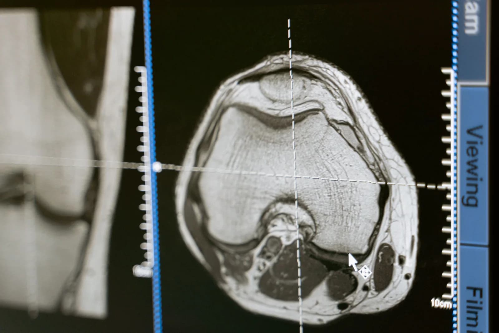 PACS and DICOM MRI image import interface