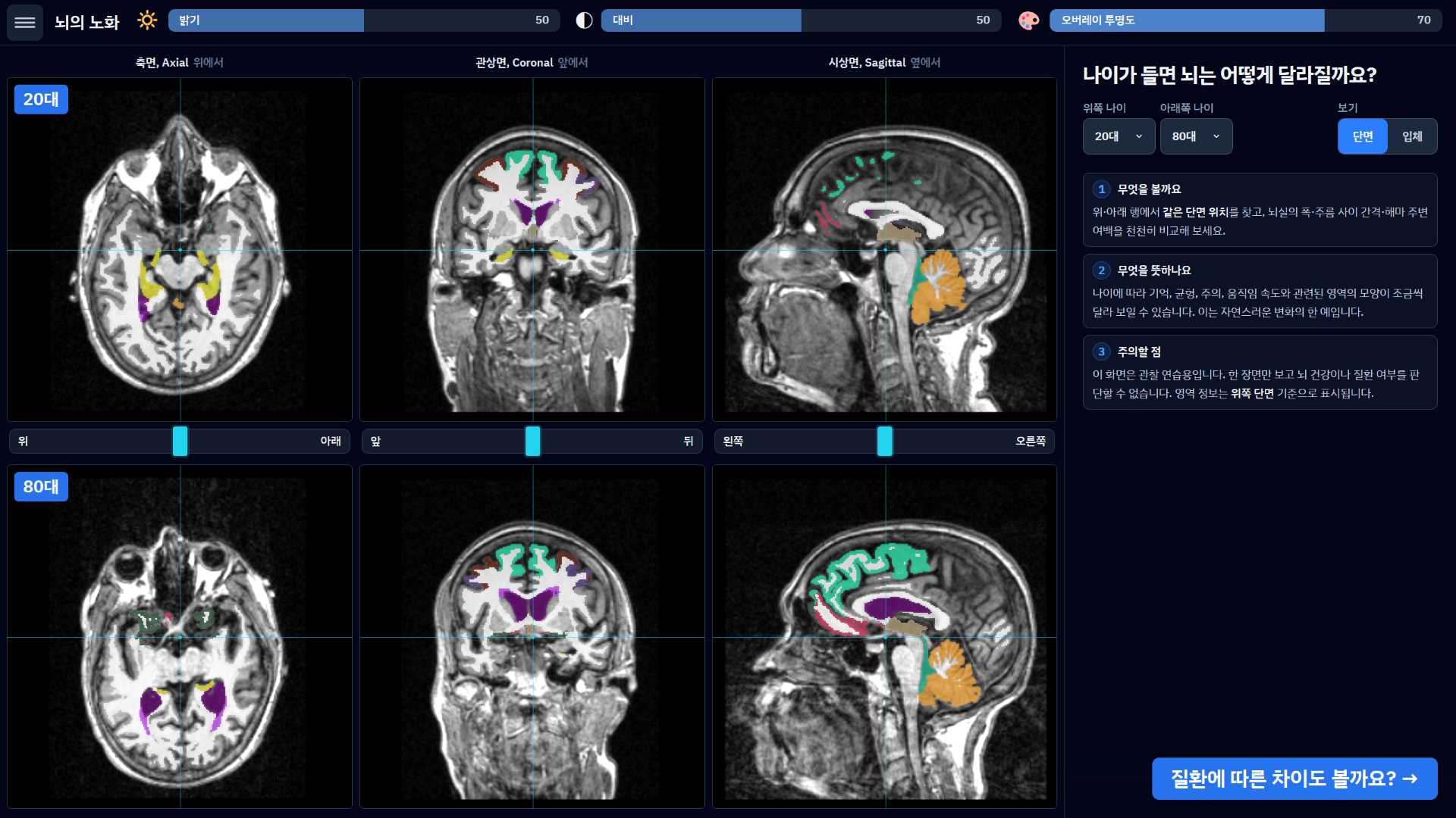 How the brain ages screen