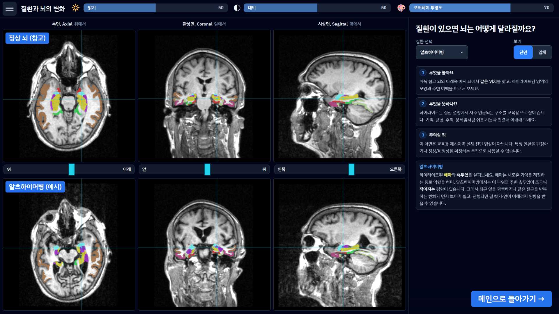 Disease and how the brain changes screen