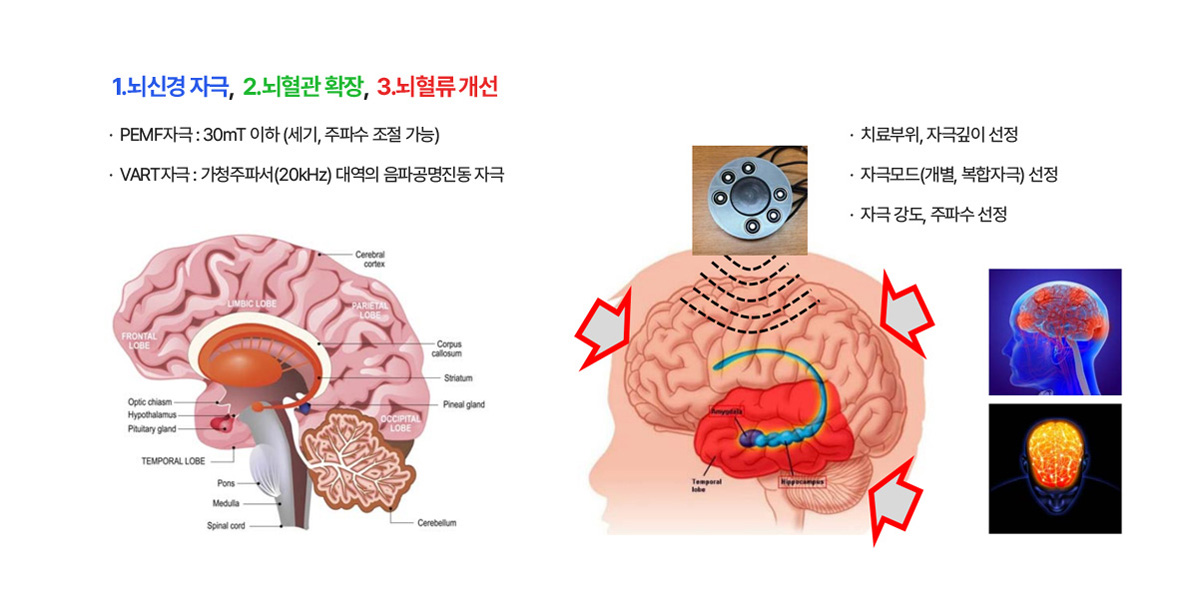 통합모듈형 경두개 자극 시스템