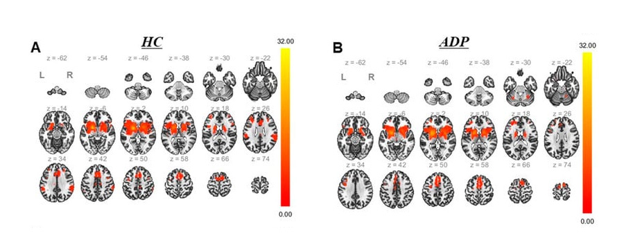 Functional MRI