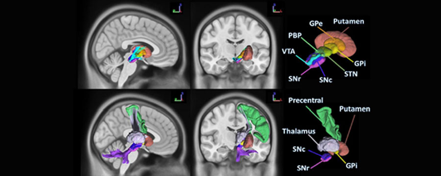 Diffusion MRI