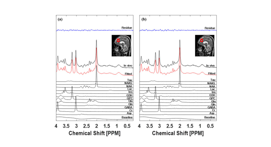 Diffusion MRI